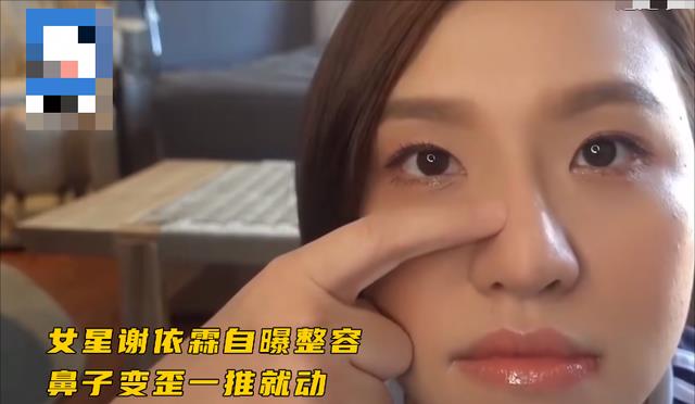 谢依霖|8位女星自曝动脸经历：王鸥打瘦脸针致使面瘫、谢依霖假体歪掉