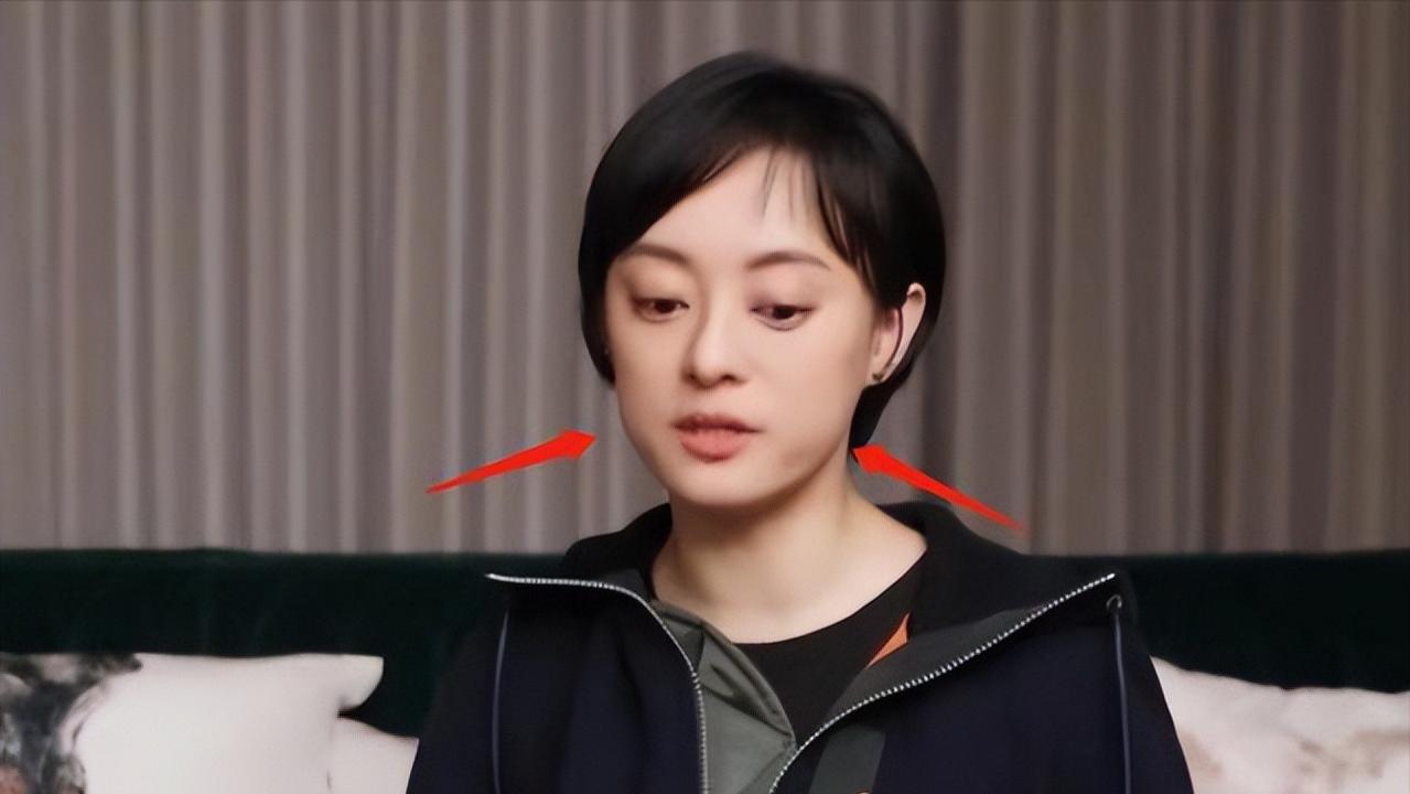 孙俪|孙俪近照引争议！眼凸脖颈鼓包，无效养生被指像青蛙