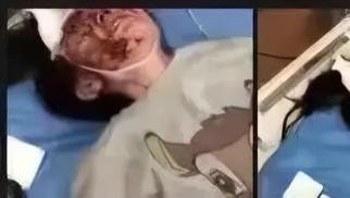唐山事件中另一女生伤情鉴定出来了！右眼可能会失明，网友应多关注