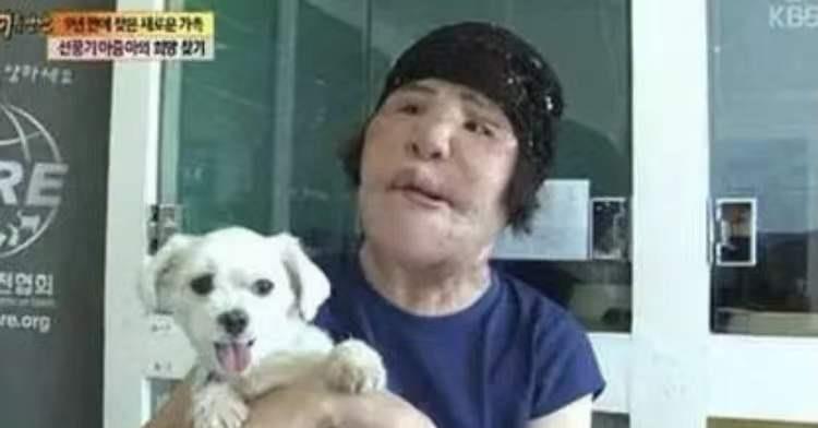 王一博|女星韩慧景:为了更漂亮,给脸注射食用油,把脸整成“猪头”