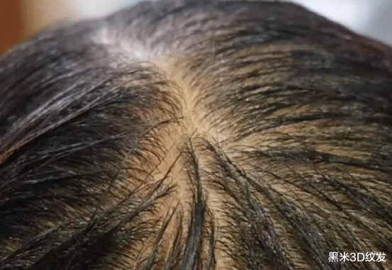 抗癌|什么是全国护发日，教你如何科学护发？