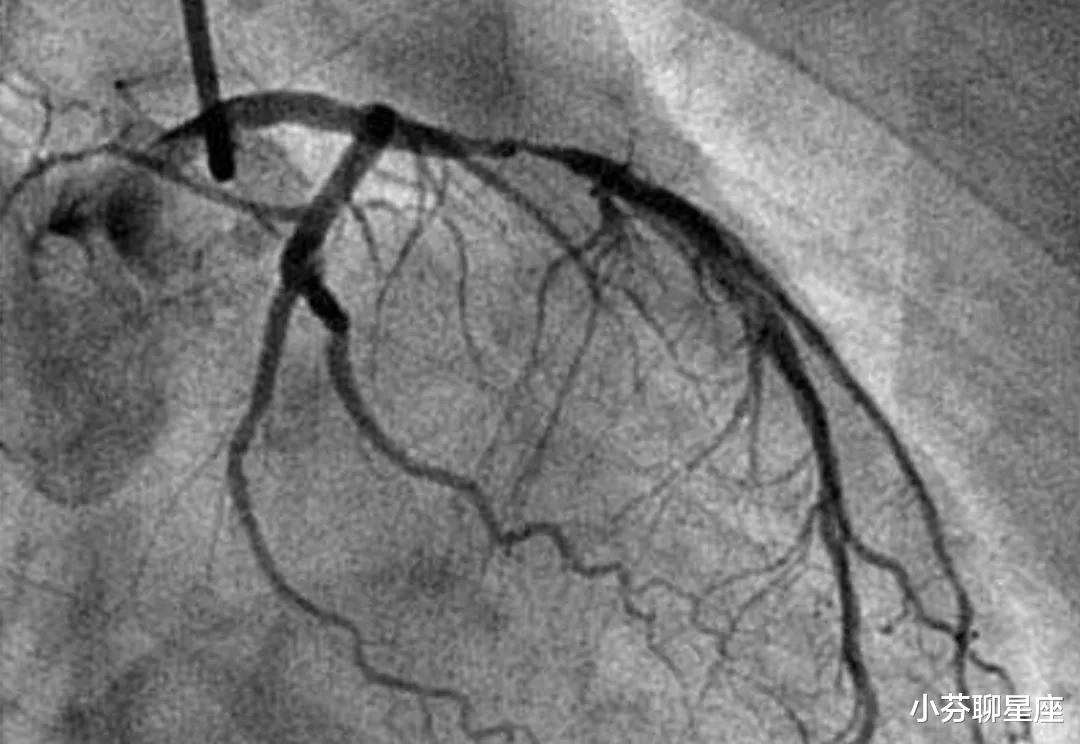 骨折|医院如果取消检查费用会发生什么?医生坦言:会出现这3大问题