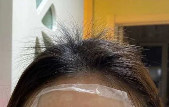 刘雨昕 防脱生发液如何选?这四款国货之光值得永远回购,秃头女孩赶紧收藏!!