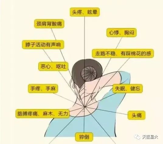 |针灸:8种方法治 颈肩综合症,效果好!