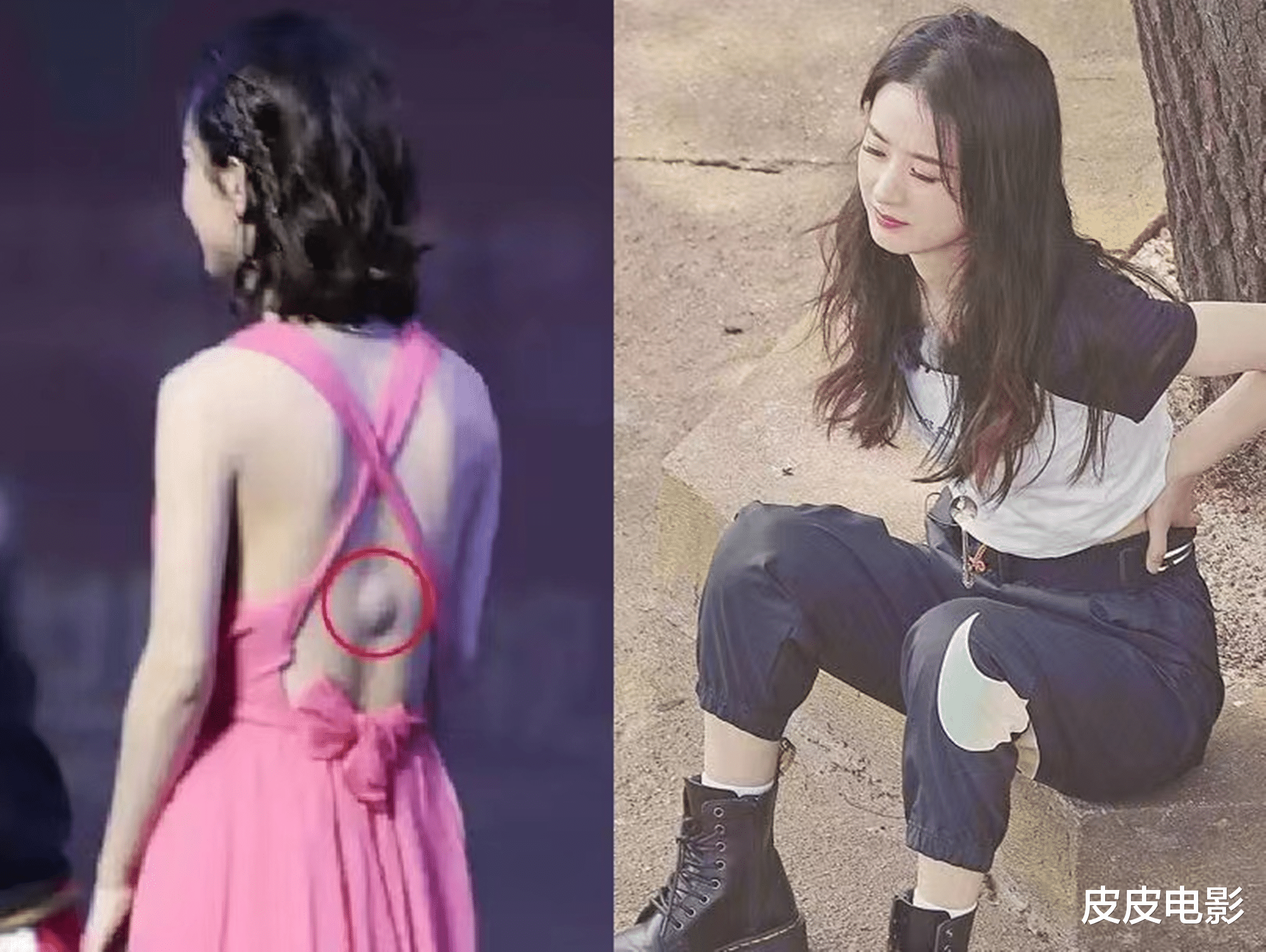 张小斐|欧阳奋强的下巴,刘亦菲的颈椎,明星风光背后,有多少难言的隐疾