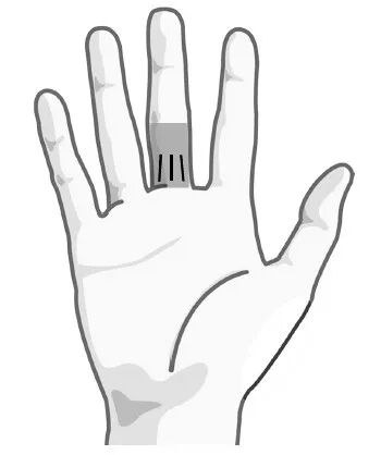 疾病|身上5个部位出现“青筋凸起”，或是身体在“报警”，及时检查