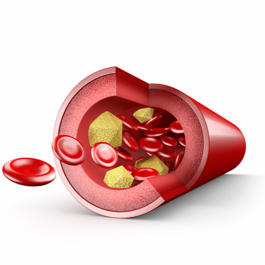 胆固醇|什么是坏胆固醇?坏胆固醇升高后,身体会出现哪些变化?早做了解