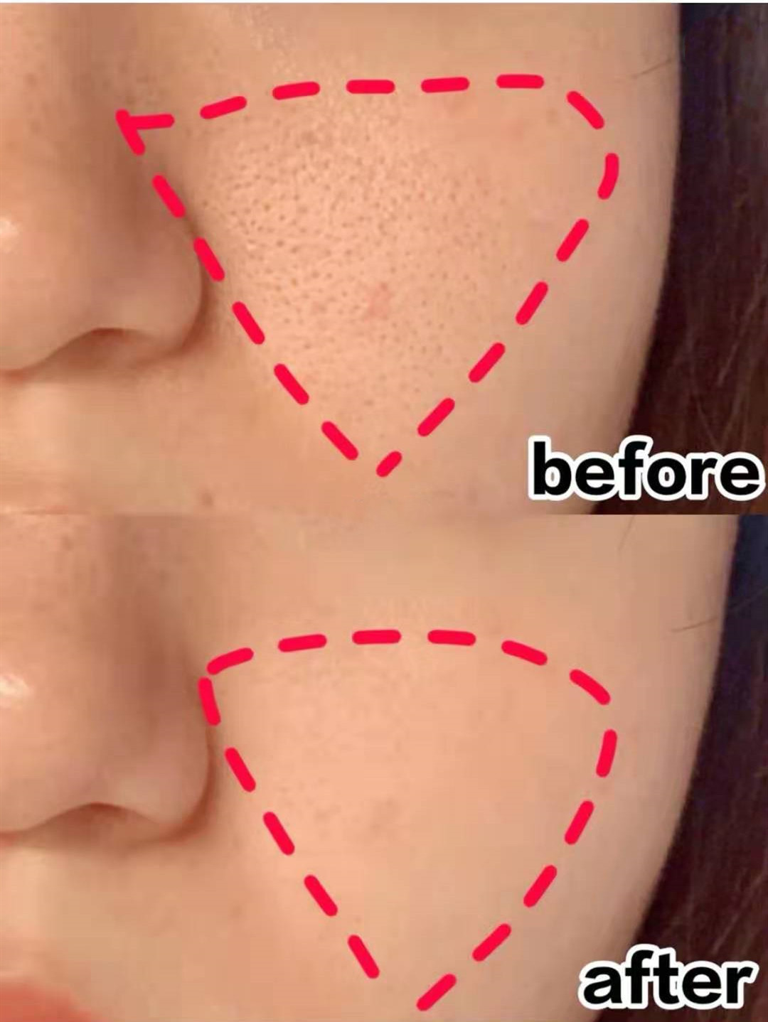 粉底液 有一种“尴尬”叫女星卡粉,高清镜头下妆容斑驳,细纹卡粉显老10岁