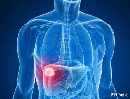 腰椎间盘突出|皮肤出现这8种变化，可能是癌症发出的信号！