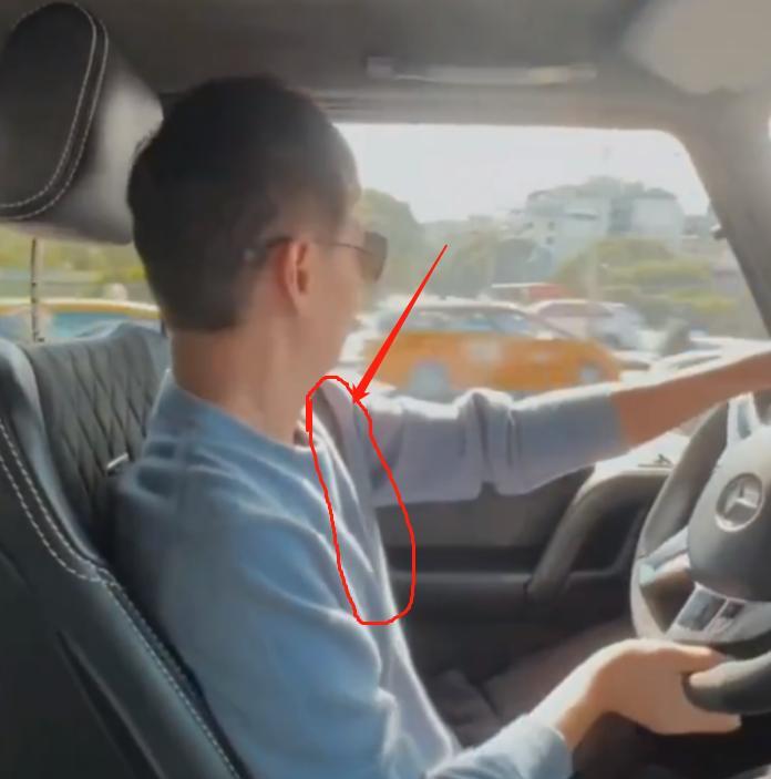 林志颖|林志颖车祸后再开车,面部又扁又平颜值难回!