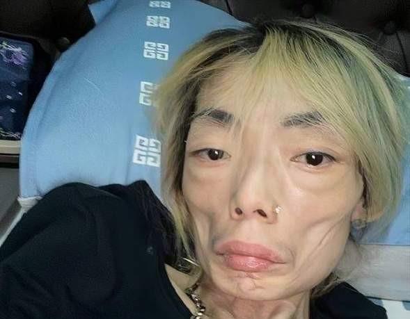 饮食 5位明星减肥前后大变样,有人瘦到脱相,有人只剩44斤,太吓人