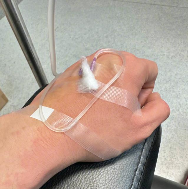 |黄晓明患肠胃炎和寻麻疹进医院，手臂大片红肿，自嘲不能放纵自己