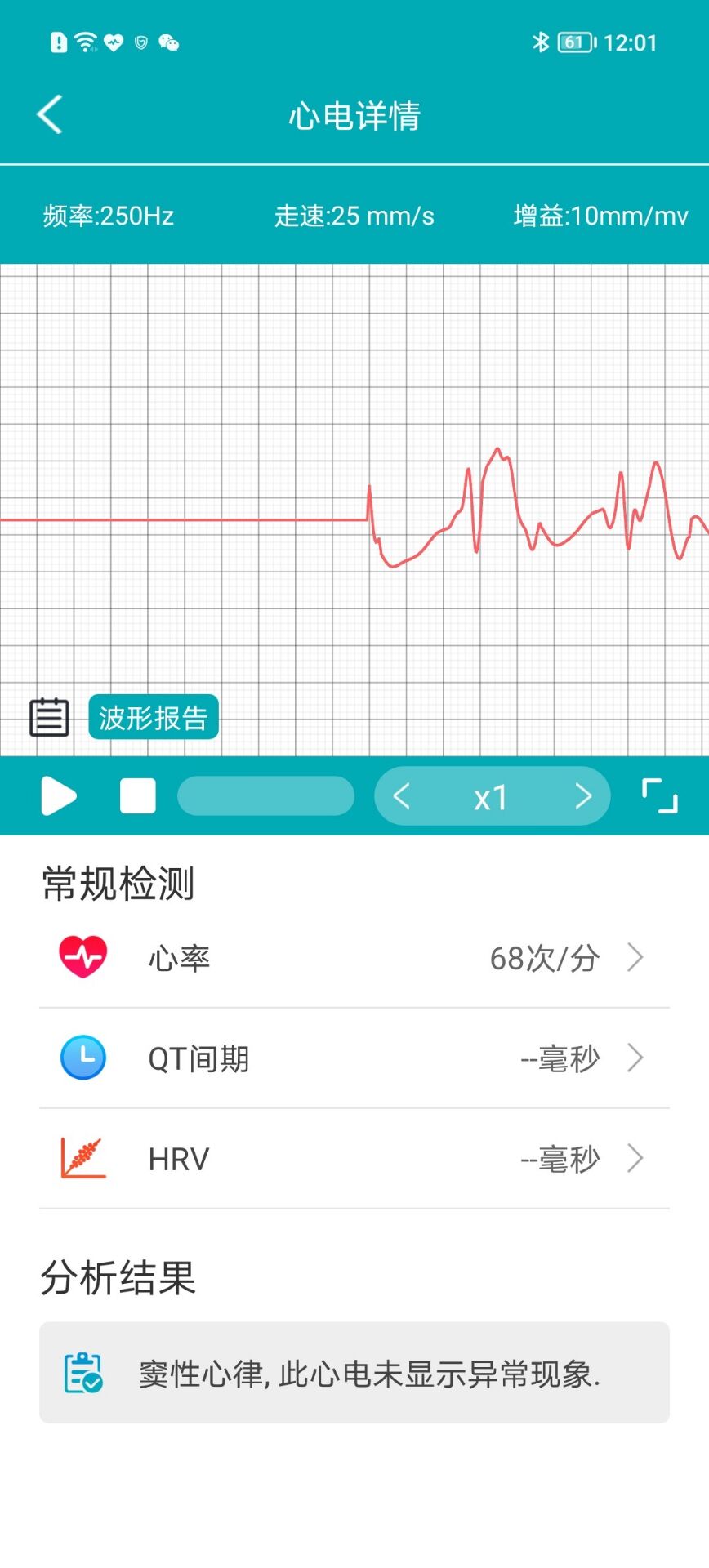 dido|比智能手表还要卷的手环，全天测心电血压，dido Y1带你认识一下~