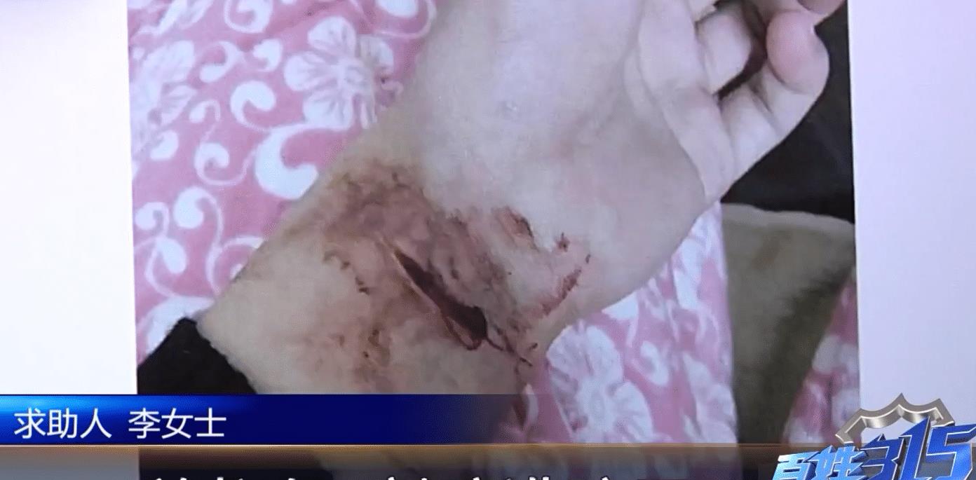 感冒|女子隆胸后怒告医院：我才20岁，和老公同房一点知觉都没有