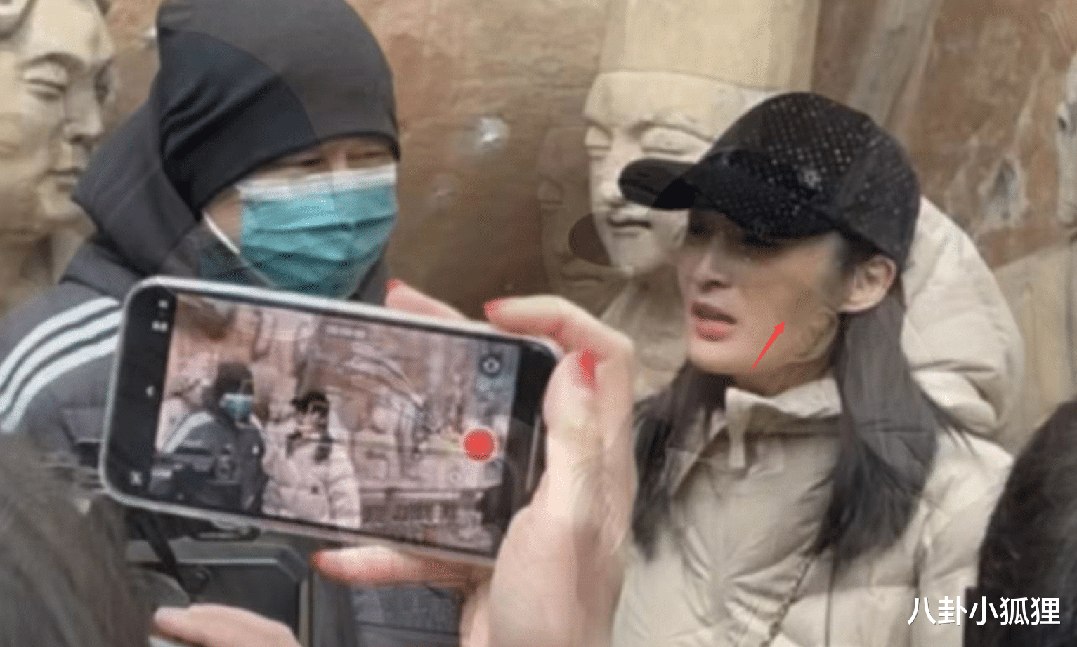 蒋勤勤|47岁蒋勤勤回娘家,被路人拍下高清生图,脸上被指有大片黄褐斑