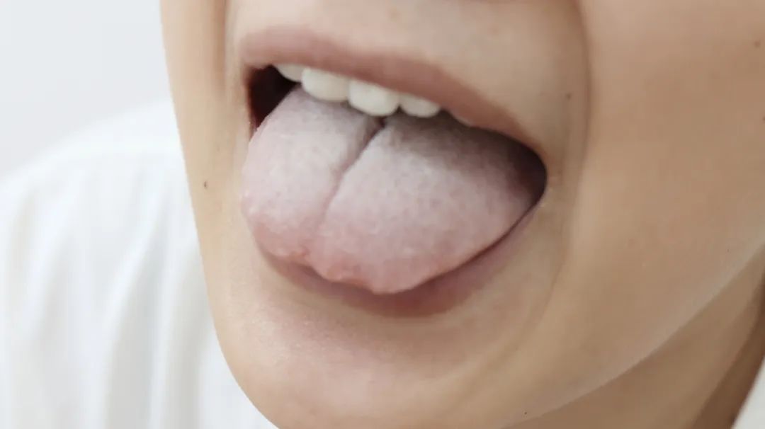 祛湿|身体出现这5种情况,说明体内湿气重,究竟该如何祛湿?你知道吗