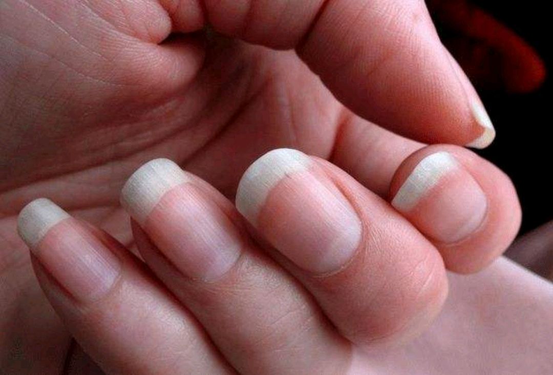 抗癌|名医孙秉严，第一代中医抗癌专家，独创“以毒攻毒”疗法，效果好