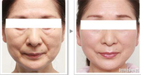 温碧霞|长期使用精华的皮肤,三年后会变成什么样子?说出来你都不敢相信