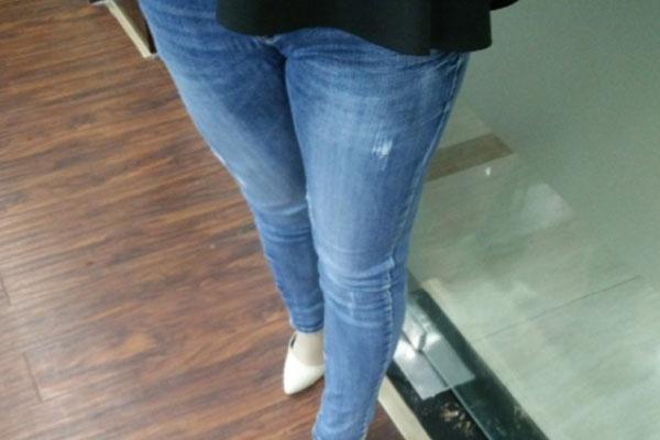 血栓|腿上有这四种表现，需多注意，很可能是血管被堵住了