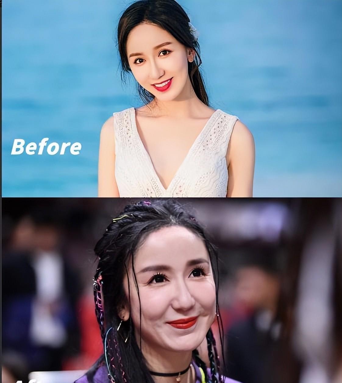 整容|九位女星的整容路:有人葬送事业,有人堪比毁容,“傻妞”可惜了