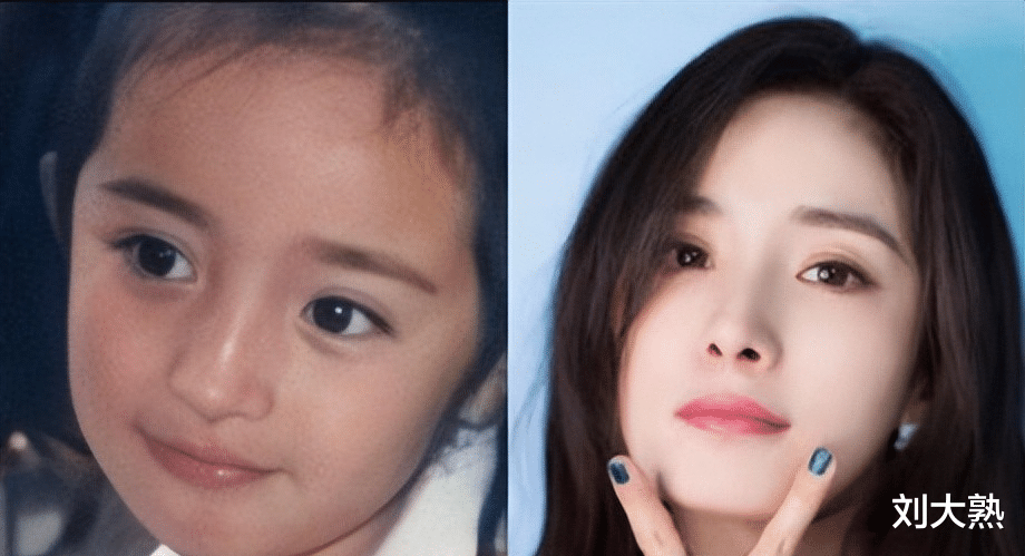 整容|6位明星“换头改命”,孩子却跟他们整容前一样,基因骗不了人