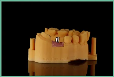 aiot|3D打印在口腔领域上的应用会在未来有明显的体现吗?