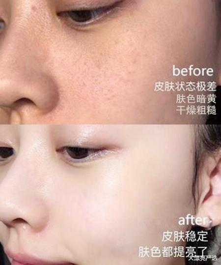 面膜 女生不管多少岁，别在“3个时辰”贴面膜，不但费钱可能还不管用