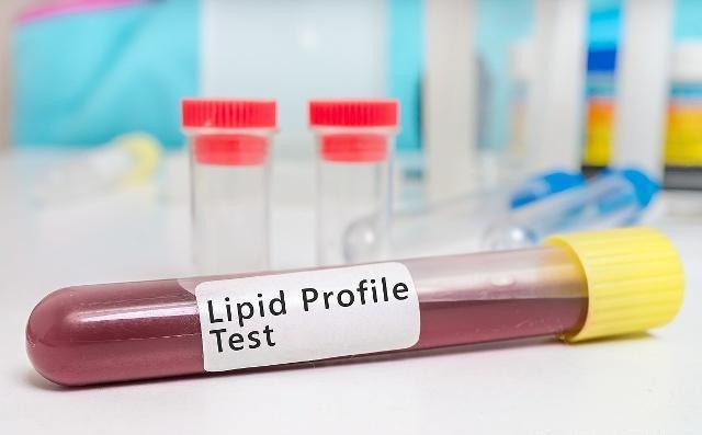 长寿|高血脂的“恩人”已找到,早晚吃一点,降血压、血脂,心脏更健康