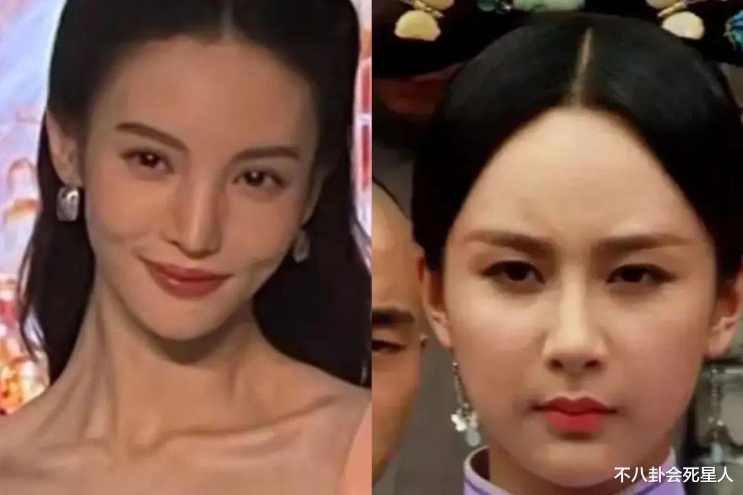 发际线 强行扮嫩、动脸成瘾、为减肥切胃洗肠，女星的畸形审美真恐怖