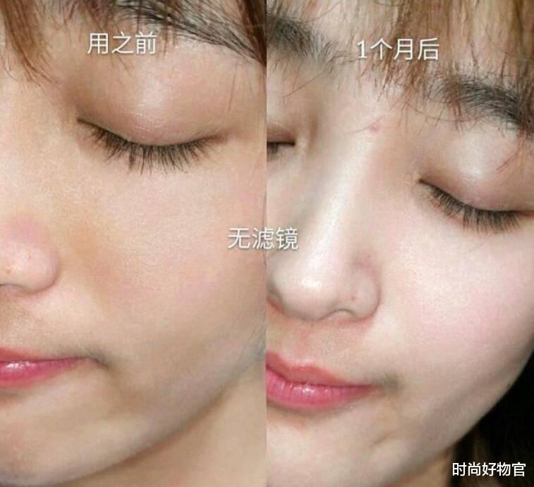 淡妆 为什么精华液不能直接上脸？谨记这2点，网友：当心满脸长闭口