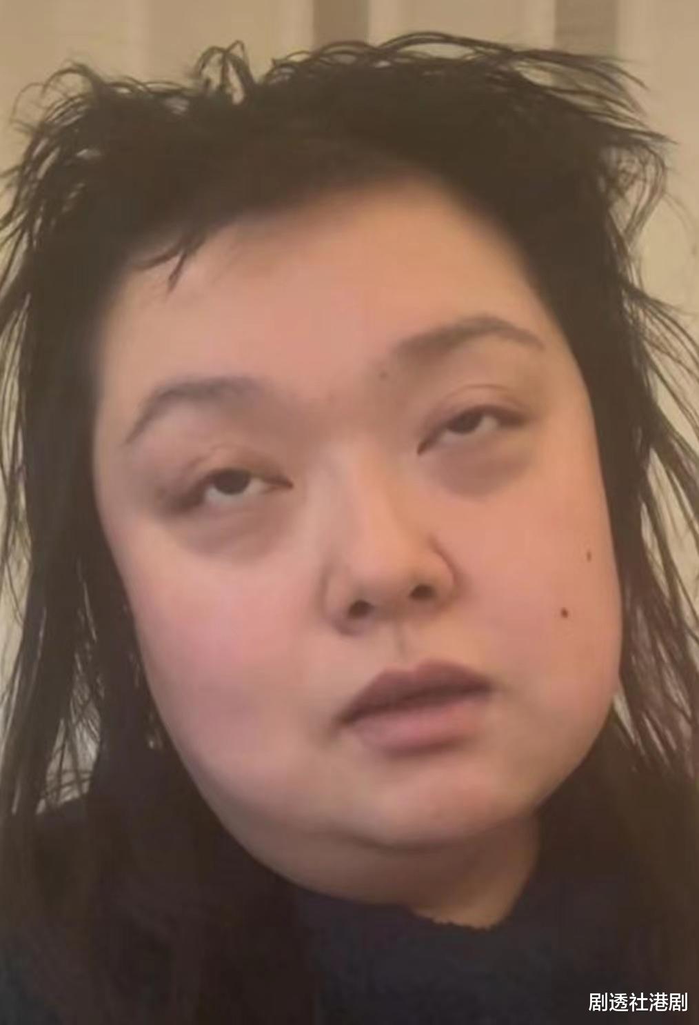 陈嘉佳|憔悴！TVB前搞笑女星晒病恹恹近况，曝三天没洗头没洗澡连狗都嫌臭