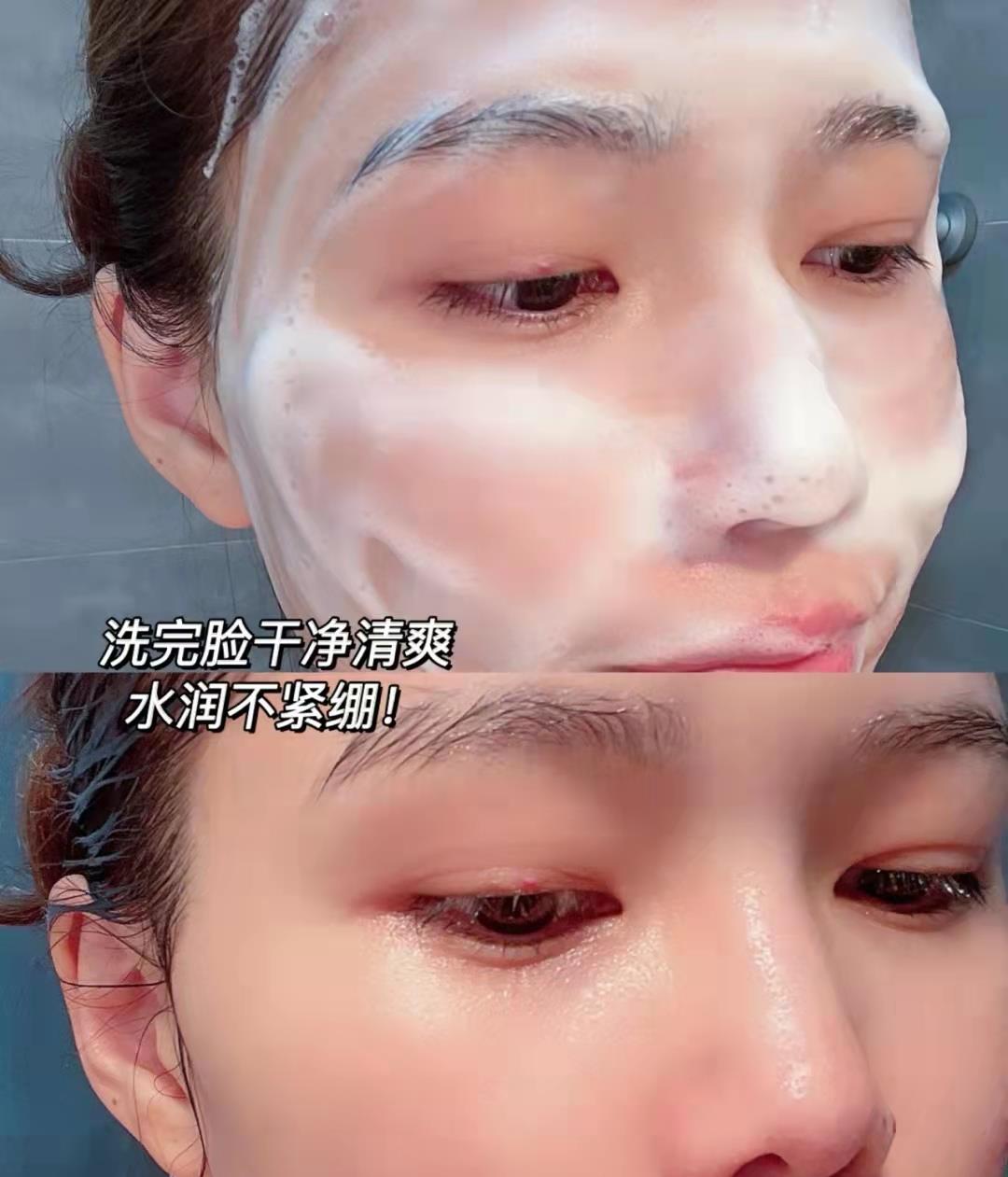 洗面奶 洗脸时有这5个好习惯的人,皮肤不仅水润,痘痘、黑头还越来越少