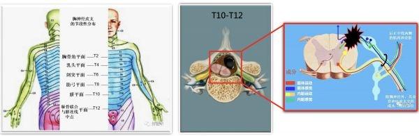 肿瘤|一年内“被”做两手术,长期腹痛竟是脊柱惹祸