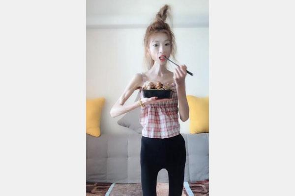 祛斑 从120到58,行走的“骷髅妹”为爱瘦身:那些被减肥毁掉的女孩们。