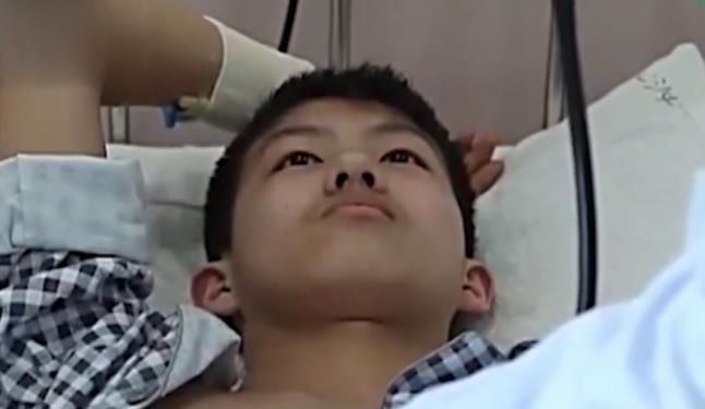 2015年,东北少年看病时心脏上发现铁针,医生:一天被扎十几万次