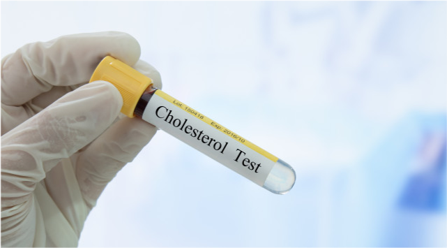 近视|少吃肥肉，多吃素就能降血脂？未必！5种素食，血脂高的人要少吃