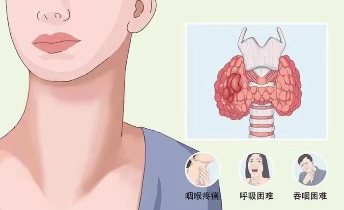 痛风|甲状腺结节日益增多？医生：1水果比“碘盐”还可怕，趁早戒掉