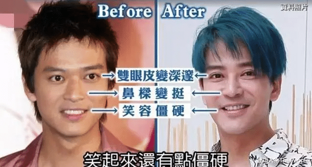 陈晓东|香港男神也整容？46岁陈晓东变“悲伤蛙”，林峰医美过程被曝光