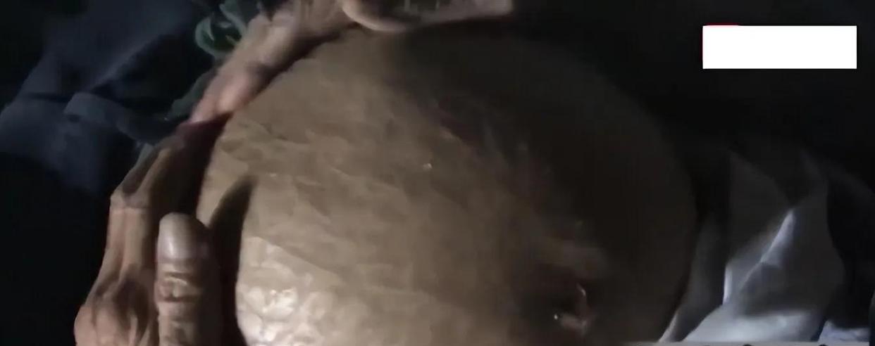 07年四川91岁老太摔一跤后，到医院竟查出怀孕，引出60年前秘密