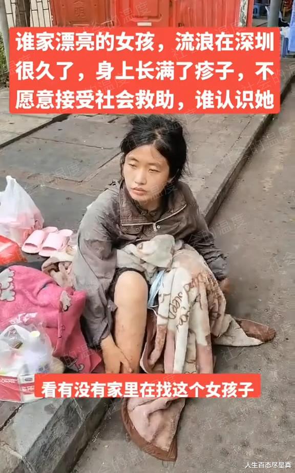 深圳:年轻流浪女抱着毯子睡马路,身上长满湿疹,男友不知所踪