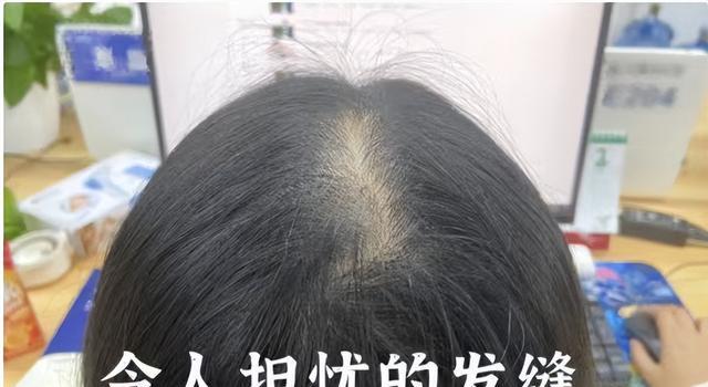 长期上班真会变丑吗?网友晒对比图,肉眼可见的沧桑,打工人哭了
