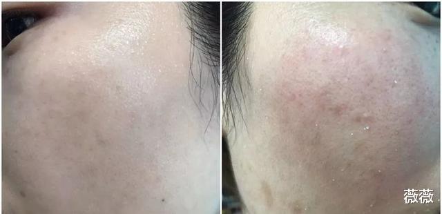 屈臣氏 屈臣氏员工无情揭露：这些“昂贵护肤品”他们从来不用，只是在浪费钱