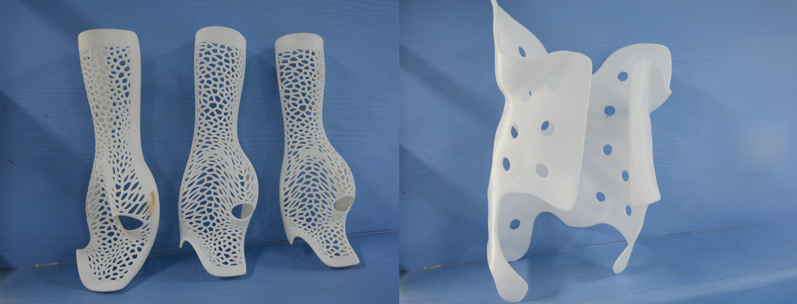 3D打印|粥多僧少？3D打印康复矫形器赛道的新机遇