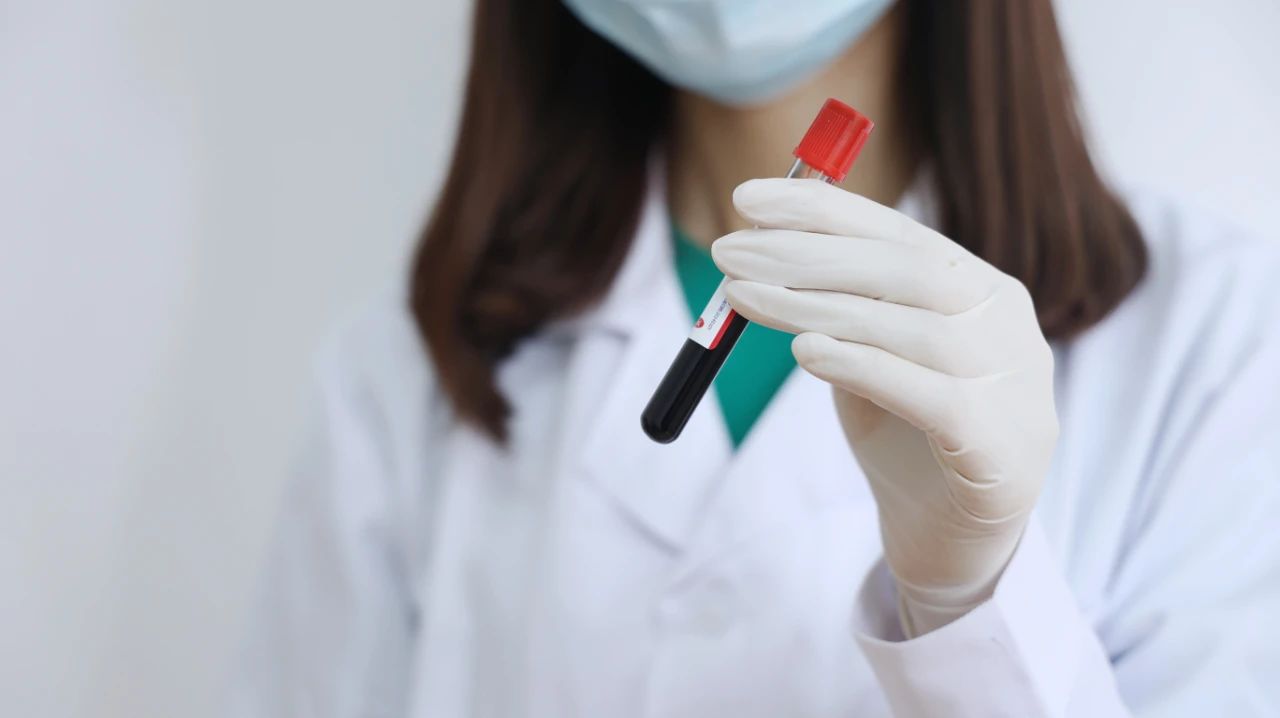 葛根|“黄痰是热,白痰是寒”的说法正确吗?哪些因素会导致频繁咳痰?