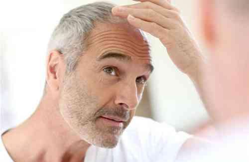 短发|染发可以让人年轻，为什么很多头发花白发的中年男士都不染发了？