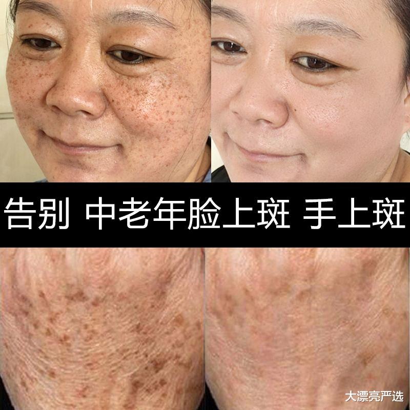 护肤品 水、乳、霜、精华的正确护肤步骤，顺序反了无效还伤肤，得不偿失