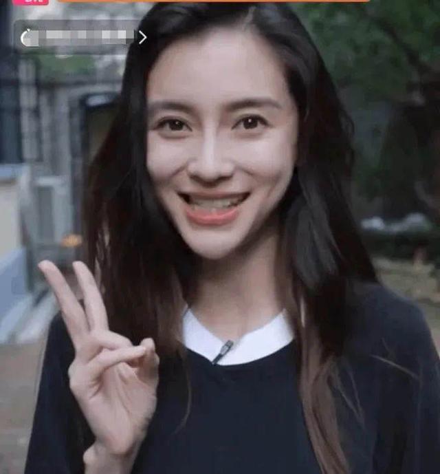 整容 明星整容后遗症:“一刀削”脸僵挂不住肉,演戏五官乱飞,没眼看