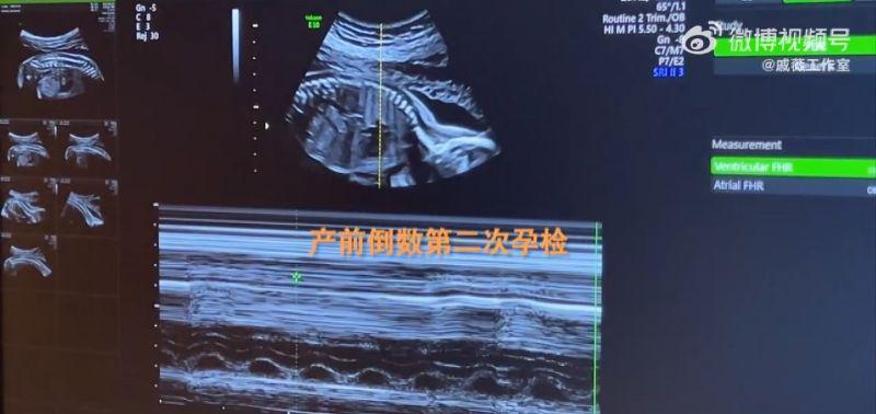 李承铉|李承铉官宣戚薇生啦！公开孕期Vlog超爆笑！Lucky初见弟弟反应太萌