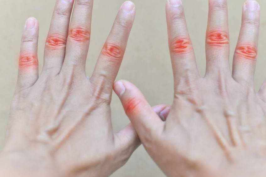 便秘|尿酸高不能吃肉?医生:可以吃,但需做好这些,否则尿酸会波动!