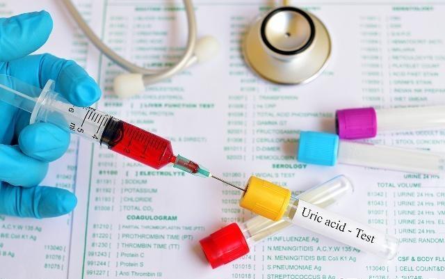 尿酸|尿酸高的人要忌口,尤其这些你常吃的食物,嘌呤含量高到超乎想象